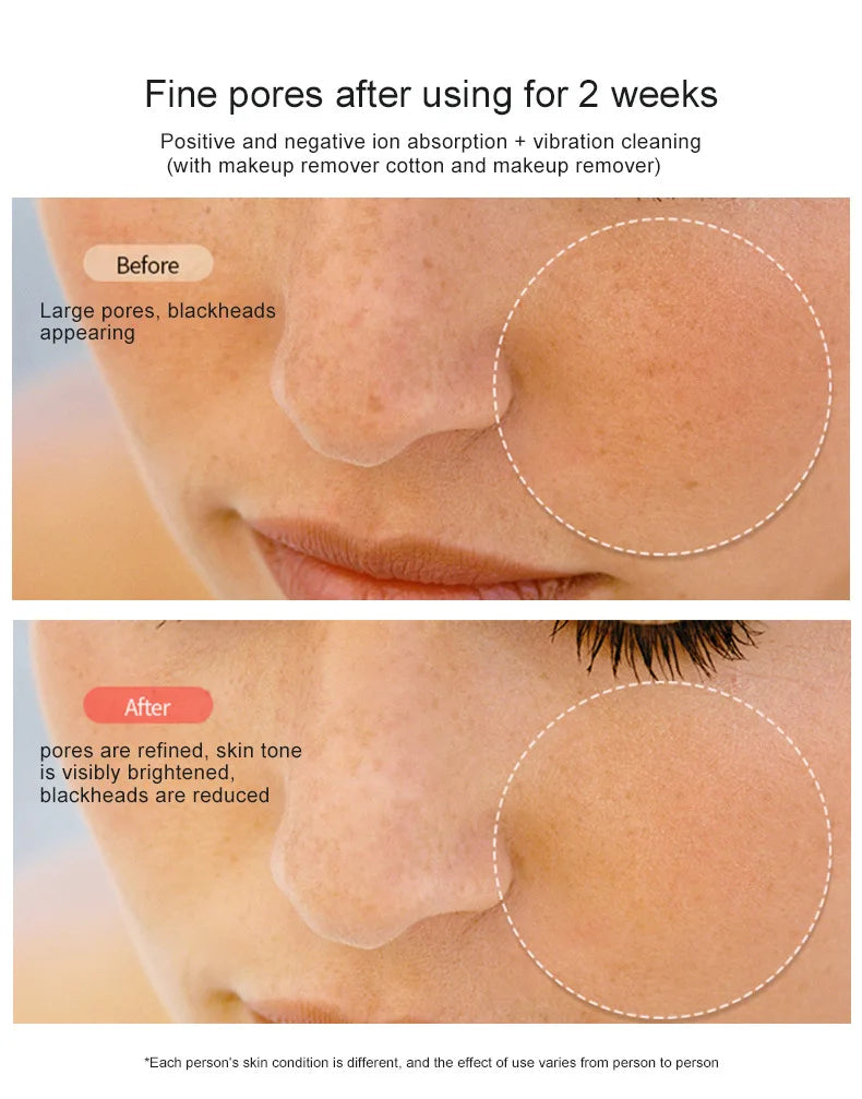 New Facial Lifting and Firming Rejuvenation RF Beauty device Home Face  device  EMS Microcurrent Beauty device Gift